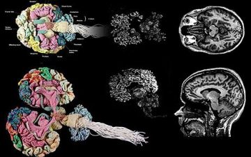 Behold an Anatomically Correct Replica of the Human Brain, Knitted by a ...